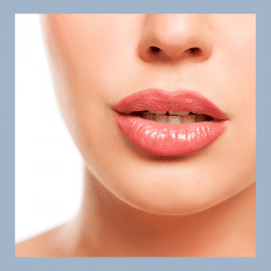 Labios